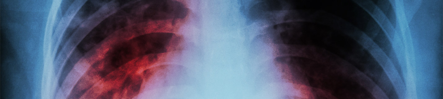 iScope enfermedades infecciosas